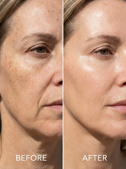 Face-Refine 7-in-1 LED Facial Sculptor